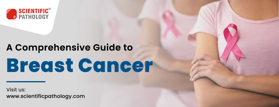 A Comprehensive Guide to Breast Cancer - Scientific Pathology